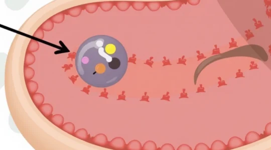 oral-herpes-on-the-tongue-symptoms-and-care